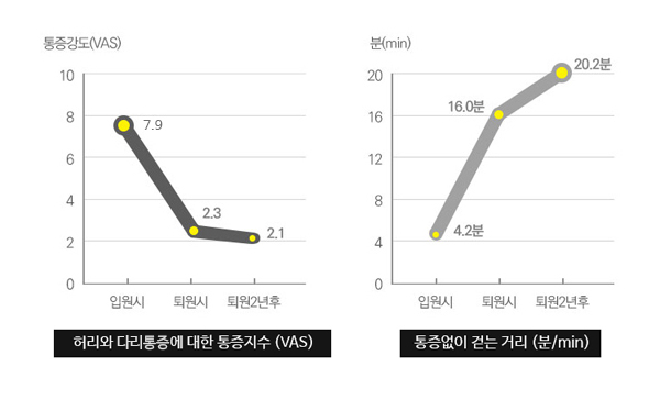 허리와 하지방사통에 대한 통증지수 (VAS) / 통증없이 걷는 거리 (분/min)