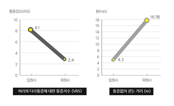 허리와 하지방사통에 대한 통증지수 (VAS) / 통증없이 걷는 거리 (m)